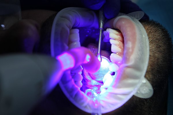 Exploring the Effectiveness of Guided Imagery for Alleviating Pain in Dental Treatments